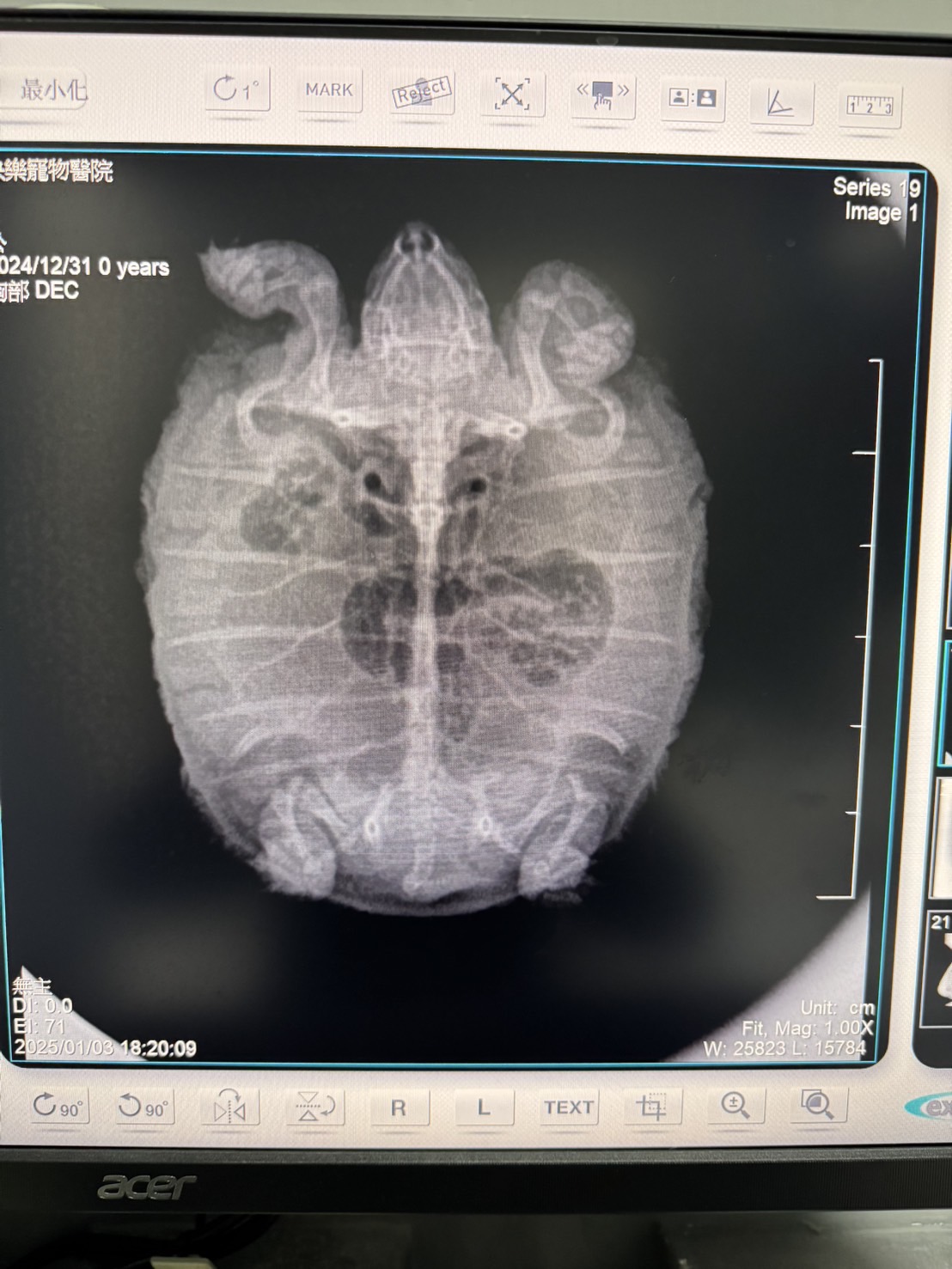 手持式DR
