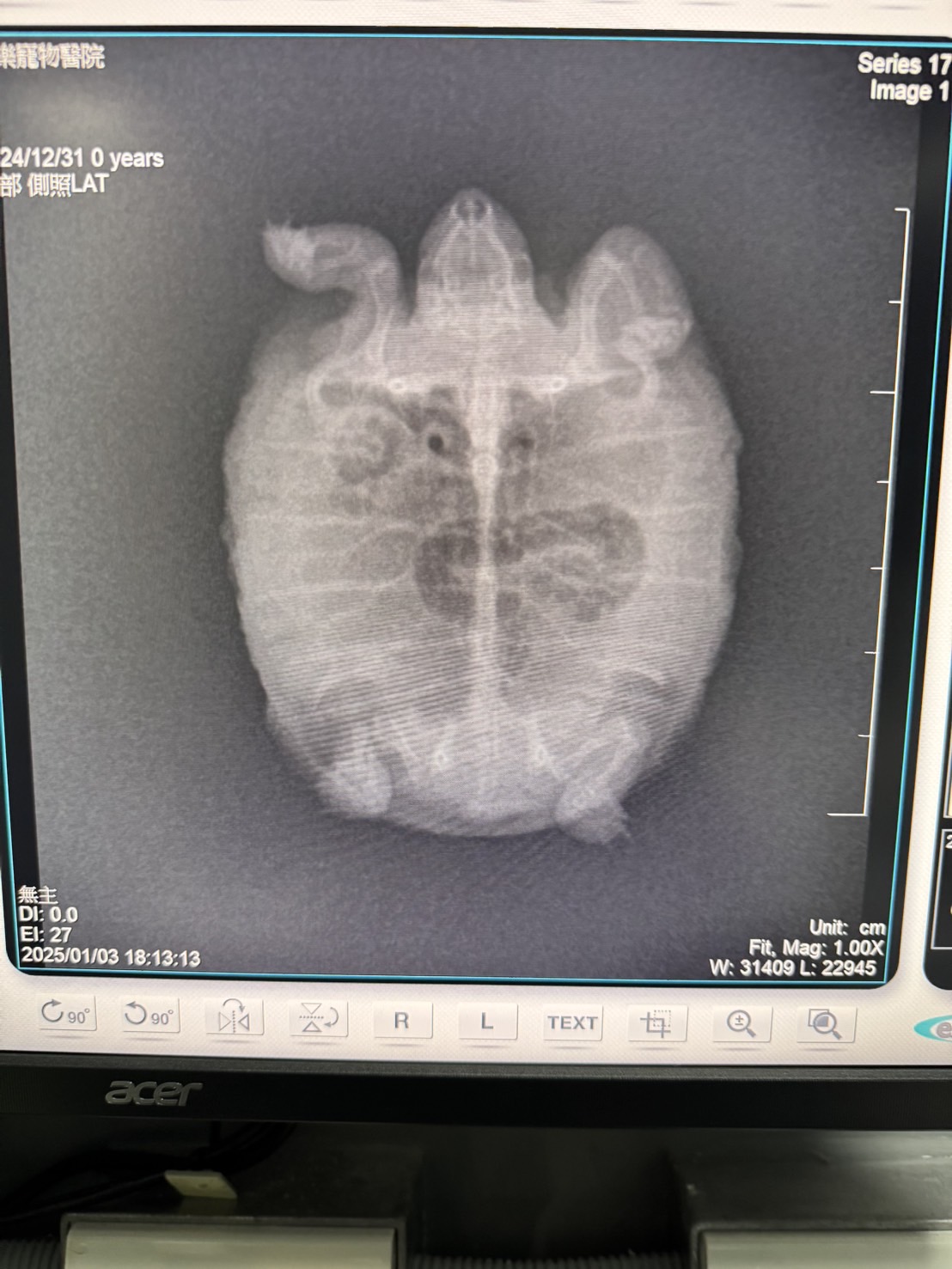 手持式DR